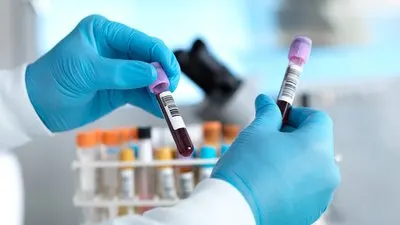 Виїзне тестування у Чернігові: виявлено випадки ВІЛ, гепатитів і сифілісу